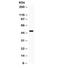 Serine/threonine-protein kinase Sgk1 antibody, R31780, NSJ Bioreagents, Western Blot image 