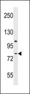 Adhesion G Protein-Coupled Receptor L3 antibody, 59-359, ProSci, Western Blot image 