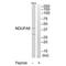 NADH:Ubiquinone Oxidoreductase Subunit A9 antibody, A07420, Boster Biological Technology, Western Blot image 