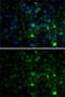 SET And MYND Domain Containing 4 antibody, GTX32886, GeneTex, Immunofluorescence image 