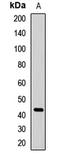 CD63 Molecule antibody, LS-C668620, Lifespan Biosciences, Western Blot image 