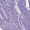 HHIP Like 2 antibody, PA5-63765, Invitrogen Antibodies, Immunohistochemistry frozen image 