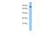 Zinc finger protein 109 antibody, NBP2-36484, Novus Biologicals, Western Blot image 