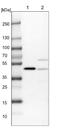 Programmed Cell Death 2 antibody, NBP1-80819, Novus Biologicals, Western Blot image 