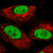 Poly(ADP-Ribose) Polymerase 1 antibody, AMAb90959, Atlas Antibodies, Immunofluorescence image 