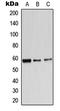 Adrenoceptor Alpha 1B antibody, LS-C351804, Lifespan Biosciences, Western Blot image 