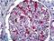 S100 Calcium Binding Protein A6 antibody, LS-B5528, Lifespan Biosciences, Immunohistochemistry paraffin image 