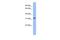 T Cell Leukemia Homeobox 1 antibody, PA5-41499, Invitrogen Antibodies, Western Blot image 