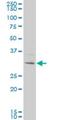 Potassium Channel Tetramerization Domain Containing 4 antibody, H00386618-M04, Novus Biologicals, Western Blot image 