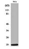 Stathmin 1 antibody, orb159596, Biorbyt, Western Blot image 