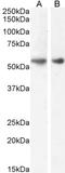 Glucagon-like peptide 1 receptor antibody, LS-C205018, Lifespan Biosciences, Western Blot image 