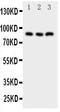 Nuclear factor of activated T-cells, cytoplasmic 2 antibody, PA1664, Boster Biological Technology, Western Blot image 
