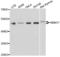 RNA Binding Motif Protein 17 antibody, LS-C335315, Lifespan Biosciences, Western Blot image 