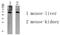 Glucagon Like Peptide 1 Receptor antibody, STJ99656, St John