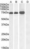 Rac GTPase Activating Protein 1 antibody, GTX22270, GeneTex, Western Blot image 