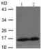Cellular Retinoic Acid Binding Protein 2 antibody, TA324128, Origene, Western Blot image 