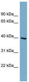 ST8 Alpha-N-Acetyl-Neuraminide Alpha-2,8-Sialyltransferase 6 antibody, TA336178, Origene, Western Blot image 