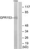 G Protein-Coupled Receptor 153 antibody, A14934, Boster Biological Technology, Western Blot image 
