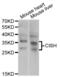 Cytokine Inducible SH2 Containing Protein antibody, abx004804, Abbexa, Western Blot image 