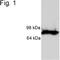 Versican antibody, PA1-1748A, Invitrogen Antibodies, Western Blot image 