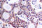 Nuclear Factor Kappa B Subunit 2 antibody, A01228S869, Boster Biological Technology, Immunohistochemistry paraffin image 