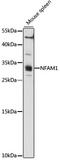 NFAT Activating Protein With ITAM Motif 1 antibody, LS-C750542, Lifespan Biosciences, Western Blot image 