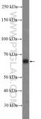 Inositol 1,4,5-Trisphosphate Receptor Interacting Protein antibody, 26055-1-AP, Proteintech Group, Enzyme Linked Immunosorbent Assay image 