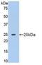 Matrix Metallopeptidase 13 antibody, MBS2002989, MyBioSource, Western Blot image 