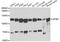 Adaptor Related Protein Complex 2 Subunit Beta 1 antibody, A1995, ABclonal Technology, Western Blot image 