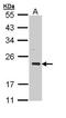Cysteine And Glycine Rich Protein 3 antibody, PA5-29155, Invitrogen Antibodies, Western Blot image 