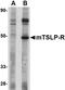 Cytokine Receptor Like Factor 2 antibody, orb74835, Biorbyt, Western Blot image 
