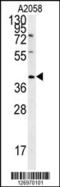 CD99 Molecule Like 2 antibody, 61-953, ProSci, Western Blot image 