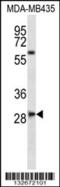 SLAM Family Member 8 antibody, 56-706, ProSci, Western Blot image 
