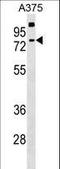 Transketolase Like 2 antibody, LS-C157201, Lifespan Biosciences, Western Blot image 