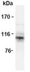 beta Amyloid antibody, ADI-NBA-100-E, Enzo Life Sciences, Western Blot image 