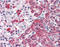 Transmembrane Serine Protease 4 antibody, TA341335, Origene, Immunohistochemistry paraffin image 