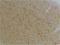 Potassium Voltage-Gated Channel Subfamily A Member 10 antibody, A11040, Boster Biological Technology, Immunohistochemistry paraffin image 
