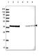 Eukaryotic Translation Initiation Factor 2 Subunit Alpha antibody, HPA064885, Atlas Antibodies, Western Blot image 
