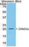 Colony Stimulating Factor 1 Receptor antibody, LS-C300345, Lifespan Biosciences, Western Blot image 