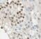 Interferon Induced Protein With Tetratricopeptide Repeats 1B antibody, FNab04136, FineTest, Immunohistochemistry paraffin image 