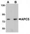 Anaphase Promoting Complex Subunit 5 antibody, TA319925, Origene, Western Blot image 