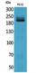 Integrin Subunit Beta 4 antibody, STJ96833, St John