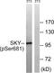 MER Proto-Oncogene, Tyrosine Kinase antibody, PA5-37808, Invitrogen Antibodies, Western Blot image 