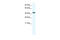 Annexin A7 antibody, 28-520, ProSci, Western Blot image 