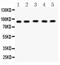 Carnitine Palmitoyltransferase 1B antibody, PA5-79065, Invitrogen Antibodies, Western Blot image 