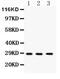 Dickkopf WNT Signaling Pathway Inhibitor 2 antibody, PA5-79155, Invitrogen Antibodies, Western Blot image 