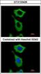 Aldehyde Dehydrogenase 1 Family Member A1 antibody, GTX123426, GeneTex, Immunocytochemistry image 