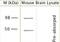 Transient Receptor Potential Cation Channel Subfamily V Member 4 antibody, NB110-74960, Novus Biologicals, Western Blot image 