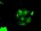 Pim-2 Proto-Oncogene, Serine/Threonine Kinase antibody, NBP2-02441, Novus Biologicals, Immunocytochemistry image 