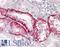 Cathepsin K antibody, LS-B4308, Lifespan Biosciences, Immunohistochemistry paraffin image 